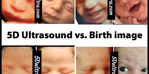 Pregnant 5D ultrasound 