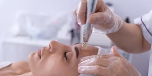 Mikroadatin\u0117s ir beadatin\u0117s mezoterapijos praktiniai mokymai Vilniuje