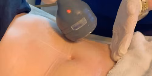 \ud83d\udd0a Cavitaci\u00f3n Corporal + Masaje Drenante o Reductor: Moldea tu Cuerpo de Forma Natural