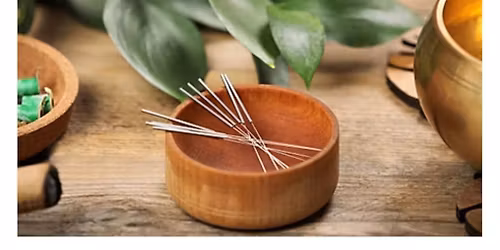 community acupuncture 