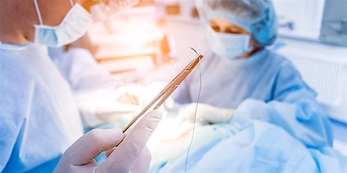 Wound closure techniques