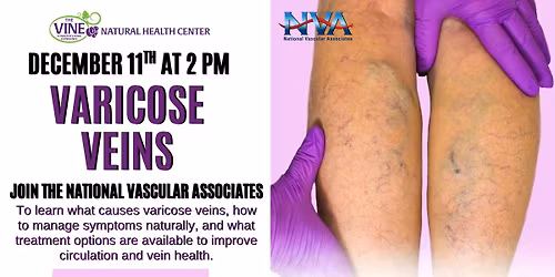 Varicose Veins Seminar
