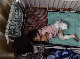 The scale of trauma-induced disability in Gaza