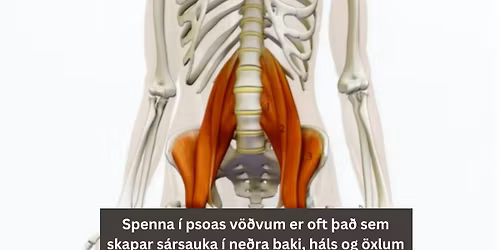 TRE\u00ae Viltu losna vi\u00f0 verki, streitu og spennu \u00far l\u00edkamanum, og n\u00e1 g\u00f3\u00f0ri hv\u00edld.