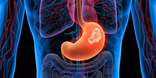 Annual Gastrointestinal Cancer Symposium