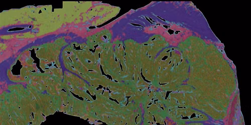 Low-cost Optical Sensing for Healthcare