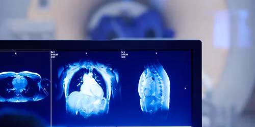 Congress Highlights - American College of Cardiology 2026