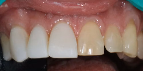 The Smile Test Drive (& Beyond), From Curiosity to Case Acceptance