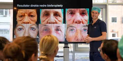 Bliv klogere p\u00e5 brillefrihed & \u00f8jenl\u00e5gsoperationer \u2013 gratis informationsaften hos Auga 