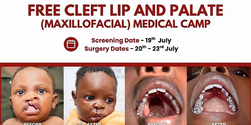 Free screening for cleft lip and palate 