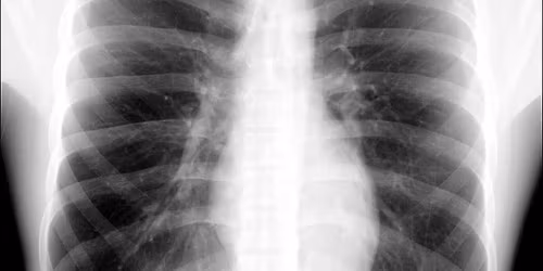 Spotkanie SKN + warsztaty