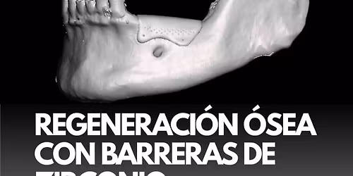 Regeneraci\u00f3n \u00d3sea con barreras de Zirconio