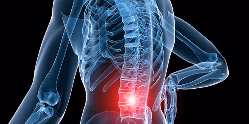 Yoga for Back Pain