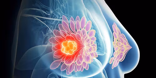 Breast Imaging In-Person Course