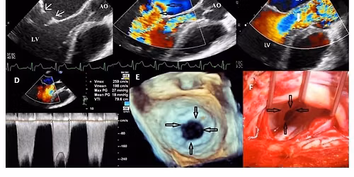 The Greater Kansas City Echo Society Annual Symposium 2026