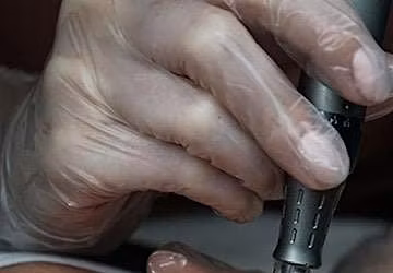 Advance Technique Microneedling Masterclass