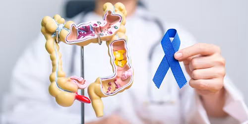 Free Colorectal Cancer Screenings