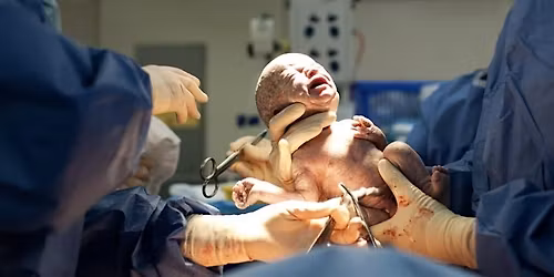 Abnormal Placentation