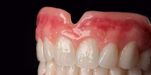 Better Dentures by Monday
