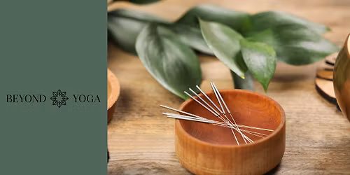 Community Acupuncture for Women's Wellness