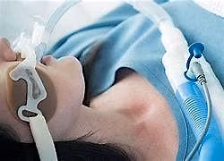 Invasive ventilation Masterclass