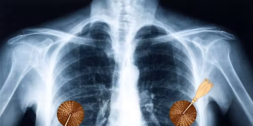 Ris-kabarett \u00e1 R\u00f6ntgen