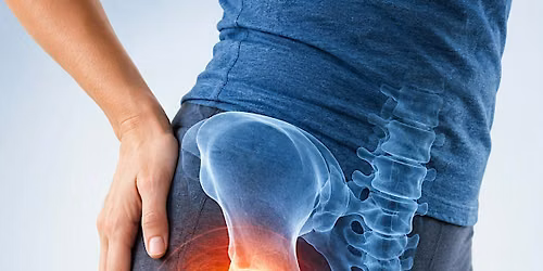 Hip Pain to Hip Replacement: The Patient Journey