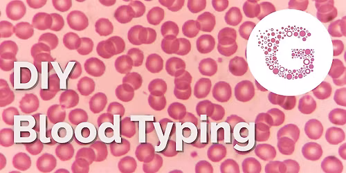 Whats Your Type? DIY Blood Typing in the Lab