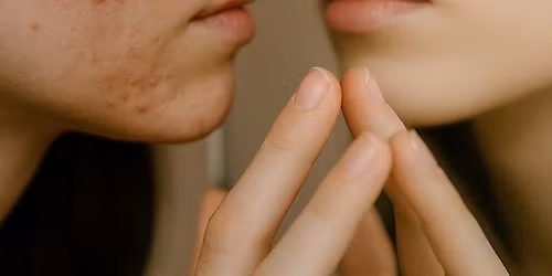 Oda be filtro: paaugli\u0173 odos prie\u017ei\u016bros paslaptys