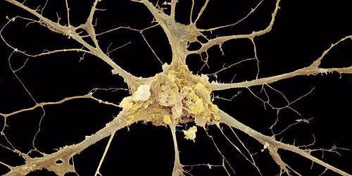 Body-Mind Centering\u00ae Saturdays NERVOUS SYSTEM