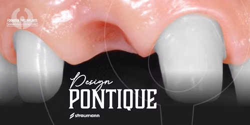 PARO-SOIR\u00c9E | Design pontique: anatomie, esth\u00e9tique et int\u00e9gration tissulaire avec Dr Berge Wazirian