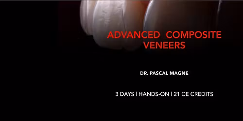 ADVANCED COMPOSITE VENEERS