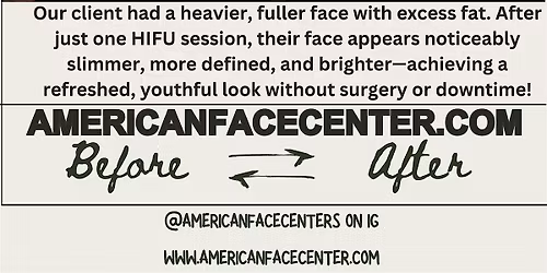 Mothers Day Skin Tight Event - American Face Center