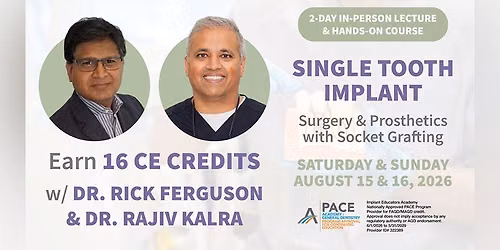 Single Tooth Implant Surgery & Prosthetics with Socket Grafting