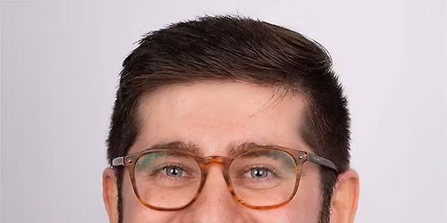 Removable Partial Dentures: Analog to Digital