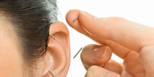 Community Acupuncture @ Bhakti Spirit