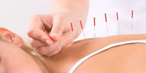 Acupuncture for pain