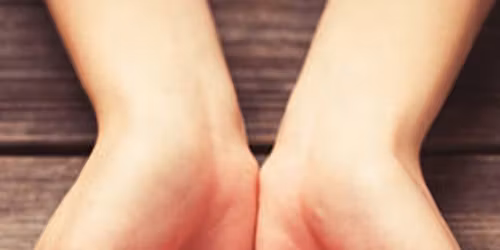 Fundraiser for Norma