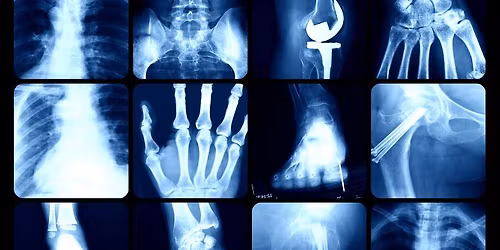 OCC Radiography Information Session- for Fall 26 start