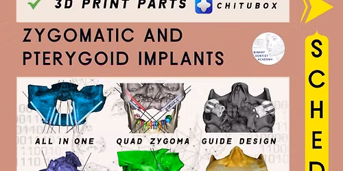 Scan to Guide \u2013 Zygomatic & Pterygoid Implants