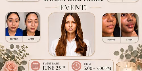 Kicking Off Summer With No More Lines and Lots Shine Event!