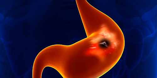 Advanced Endoscopy Series -ERCP