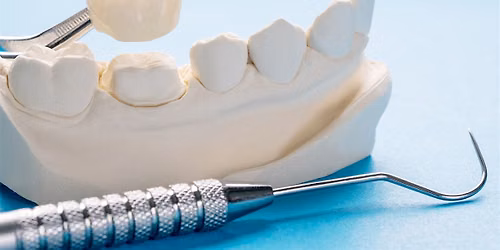 Predictable Bonding Mastery: Modern Ceramics and Next-Gen Esthetic Zirconia