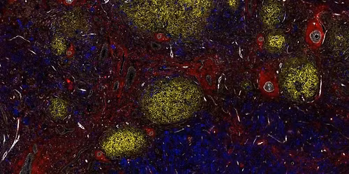 Crick Cancer Research Symposium 2026