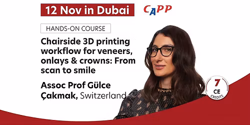 Chairside 3D printing workflow for veneers, onlays & crowns: From scan to smile