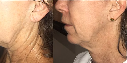 Summer Skin & Sculpt