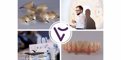 Protetyka na implantach. Praktyczne podej\u015bcie dentysty i technika