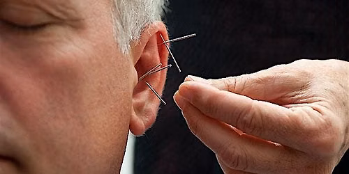 Lunchtime Reset: Community Ear Acupuncture