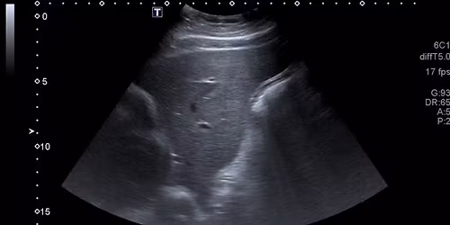 The Ultrasound Workshop