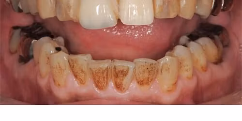 Power, Polish and Precision